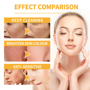 Ensemble de masques faciaux Honey Peel Mask pour les peaux à tendance <span class=keywords><strong>acnéique</strong></span> élimine les points noirs et réduit les ridules - Product Image 5