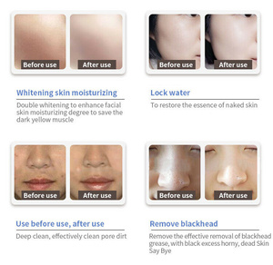 Diamond Microdermabrasion Facial <b>Machine</b> Vacuum Hydrating Features Deep Cleaning Tightening US Plug <b>for</b> Home Salon Use Model - Product Image 6