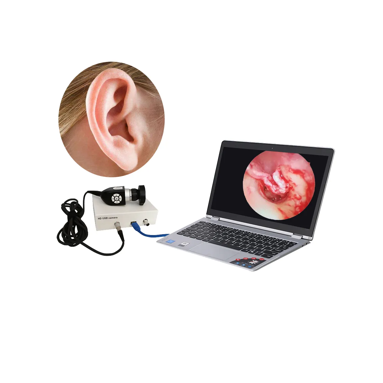 Endoscope médical CCD USB portable de haute qualité, 7 pouces, caméra endoscope vidéo numérique, à bas prix
