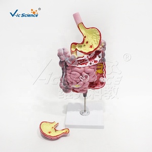 Modelo <span class=keywords><strong>de</strong></span> Enfermedad del Sistema Digestivo <span class=keywords><strong>de</strong></span> PVC, 2 Partes Desmontables, Estómago para Enseñanza <span class=keywords><strong>de</strong></span> Patología, CE ISO ROHS CNAS - Product Image 2