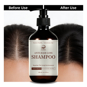 Champú Orgánico, Natural, Sin Crueldad, con Extractos Herbales, Nutritivo, Anticaída, Fortalecedor para Cabello Fino, Reduce la Caída del Cabello - Product Image 4