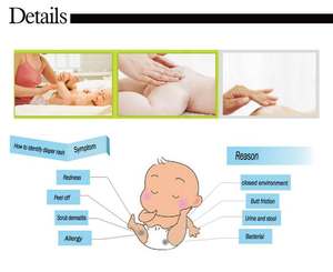 <span class=keywords><strong>Crema</strong></span> para la Dermatitis del Pañal para Bebés Popular en 2025, <span class=keywords><strong>Crema</strong></span> de Marca Privada OEM/ODM, Protección para el Trasero con 16% de Óxido de Zinc - Product Image 5