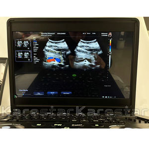 Best Verkochte Draagbare 3d 4d Kleur Doppler Echo Echografie <span class=keywords><strong>Machine</strong></span> Veterinair Pw Cw Echografie Diagnostisch Instrument - Product Image 2