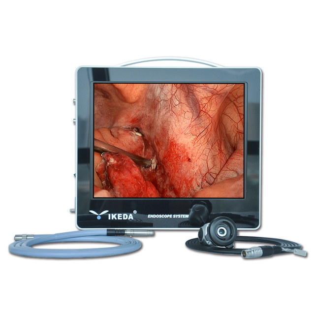 IKEDA Portable Industry Endoscope System ENT Endoscope Camera