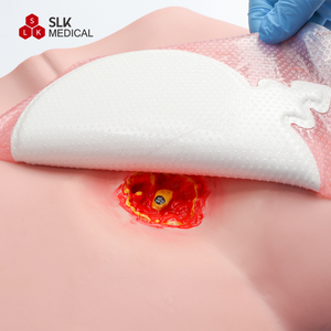 Alexer medicazione in schiuma per la cura delle ferite prodotti medici monouso per medicazione in schiuma di Sacrum per piaghe da decubito - Product Image 2