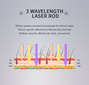 Modetrend Huidkliniek Laser Ontharing 3 Golflengten 755 808 1064 Salon Gebruik <span class=keywords><strong>Diode</strong></span> Laser Ontharingsapparaat - Product Image 5