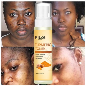 Çam kozalağı özü aydınlatma Anti akne cilt bakımı zerdeçal su spreyi yüz toniği - Product Image 1