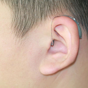 เครื่องช่วยฟังพกพาแบบชาร์จไฟได้สำหรับคนหูหนวกมี4ช่องรายการราคา - Product Image 6