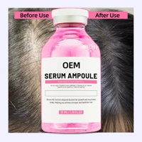 Ampoule de sérum capillaire biologique aux herbes en gros 35ml pour la croissance des cheveux et le renforcement des racines, prévention de la chute des cheveux, formule 2-EN-1