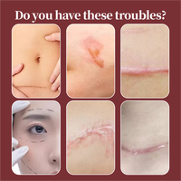 Crème gel cicatrisante en silicone de qualité médicale 30g # Pommade Recommandée par les Dermatologues pour l'Acné Chirurgicale, les Chéloïdes et les Cicatrices d'Élastorrhèse