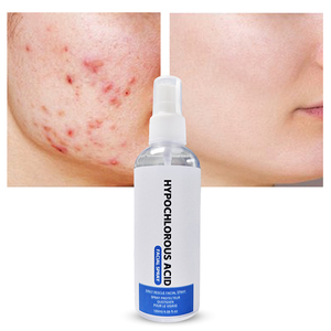 Aangepaste Logo Gevoelige Huid Roodheid Gezichtsmist Hypochlorous Face Spray Lichaam Kalmerende Hypochloorzuur Spray - Product Image 1