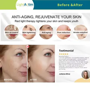 CELLUMA tıbbi sınıf cilt sıkılaştırma anti-aging kırmızı pdt yüz spa led ışık terapisi bel makinesi yüz vücut güzellik cihazı