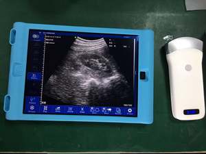 Sonde convexe à ultrasons sans fil Wifi B/W avec système Android, <span class=keywords><strong>mini</strong></span> scanner à ultrasons portable pour l'abdomen - Product Image 4