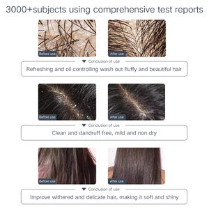 เซรั่มบำรุงผมกรดอะมิโนอินทรีย์โปรตีนขนาดเล็กโปรตีนจากพืชสารสกัดจากพืชสำหรับการบำรุงความเงางามช่วยขจัดรังแค - Product Image 6