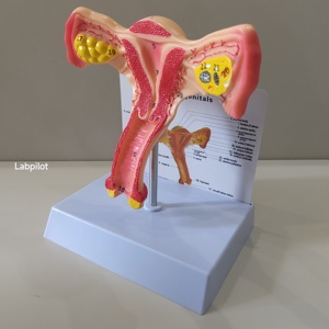 Simulador de Útero Labpilot, Maniquí de Demostración Médica, Modelo de Lesión Cervical, Entrenamiento Anatómico Escolar, Plástico PVC LP/ZG - Product Image 3