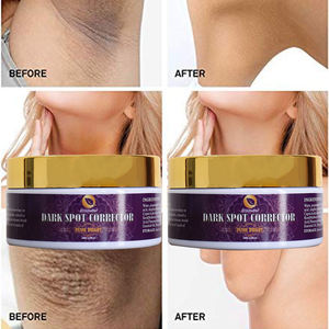 Producto superventas, crema para eliminar manchas negras, blanqueamiento de axilas, brillo, eliminación de manchas, crema blanqueadora de la piel - Product Image 4