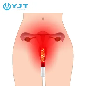 2022 최신 디자인 휴대용 여성 건강 LED 치료 악기 여성 염증 치료 장치