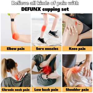 Conjunto de massagem de silicone para terapia de ventosas, ventosas ABS tradicionais chinesas, 24 copos de ventosas para o corpo - Product Image 6