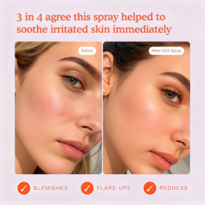 Spray Facial Vegano Orgánico Personalizado con Ácido Hipocloroso, Tónico Facial Calmante y Reparador HOCl para Enrojecimiento y Acné, OEM ODM Privado - Product Image 3