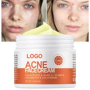 OEM logotipo personalizado cuidados com a pele orgânica anti acne tratamento remoção creme óleo controle acne rosto creme