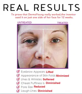 BEPEFECT Smart Magic Facial Skincare Mini Derma Young Pro Device Personal Skin Care Product Anti Wrinkle Beauty Machine