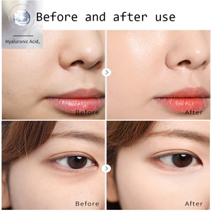 Acido ialuronico Gummies supplemento di spinta all'umidità cura della pelle vitamina C collagene e acido ialuronico gommoso per la pelle - Product Image 5