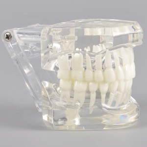 Modello Ortodontico Dentale Trasparente <span class=keywords><strong>Standard</strong></span> per Dimostrazione e Pratica dei Supporti - Product Image 2
