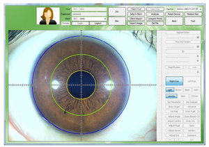 Máquina Analisadora De Saúde Câmeras Digitais Chinesas Máquina Analisadora De Saúde Analisador De Pele - Product Image 2