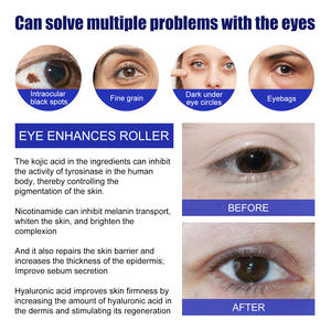 Produit le plus vendu produit tendance 2024 nouveauté cadeau de noël stylo de beauté outil de Massage du visage rouleau pour les yeux - Product Image 3