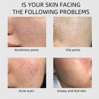 Sérum à l'acide mandélique AHA, acide salicylique, peeling acide, resurfaçage de la peau, réparation de la peau, blanchiment, régénération