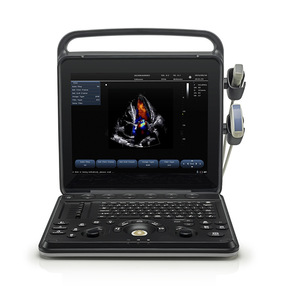 Escáner Digital Portátil de Ultrasonido Veterinario Promax PU-VP151A para Mascotas con Diseño Montable en Carro - Product Image 3