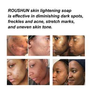 Roishun sabun cuci wajah, sabun pencuci wajah pemutih asam Kojic pemutih Label pribadi - Product Image 4