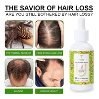 Créez votre propre logo – Huile de croissance capillaire, sérum anti-chute, élixir capillaire au gingembre, sérum stimulant la pousse des cheveux