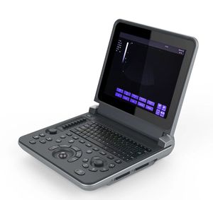 Yongyue pemindai <span class=keywords><strong>Ultrasound</strong></span> sapi domba domba babi kucing anjing Akurasi Tinggi murah untuk hewan peliharaan mesin <span class=keywords><strong>Ultrasound</strong></span> Laptop - Product Image 2