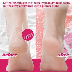 Kit <span class=keywords><strong>Spa</strong></span> Gelée : Cristaux de Sel Hydratants pour Pédicure, Bain de Pieds, Nettoyage des Cuticules et des Callosités, Gel Pédicure - Product Image 5