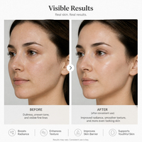 Ampoules Vegan Skinbooster NAD+ EGF OEM/ODM, Acide Hyaluronique HA, Sérum Soin du Visage Anti-Âge, Réparation du DNA, Taches Noires, Rides