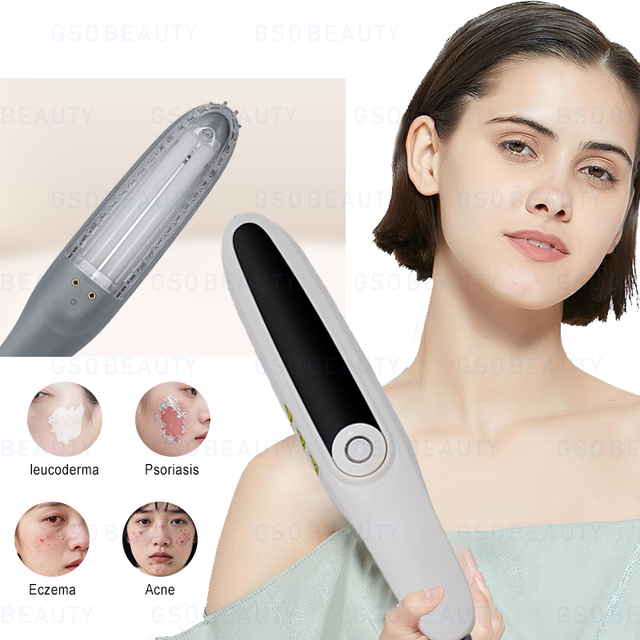 Portable 308nm UVB Phototherapy Excimer Laser Vitiligo Psoriasis Cream Treatment Uv Lamp Phototherapy Light Therapy Machine