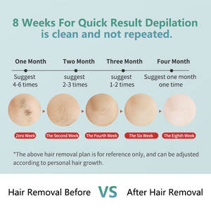 Portable Laser <span class=keywords><strong>Épilation</strong></span> Épilateur Combiné <span class=keywords><strong>Épilation</strong></span> Dispositif Épilateur Machine 2023 Permanent à La Maison Technologie IPL Dispositif - Product Image 6