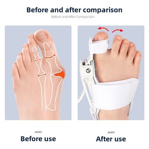 <span class=keywords><strong>Orthèse</strong></span> pour <span class=keywords><strong>Hallux</strong></span> <span class=keywords><strong>Valgus</strong></span>, Séparateur d'orteils pour os du pied en saillie et orteils superposés, Modèle réglable à bouton-pression 003 Jour <span class=keywords><strong>Nuit</strong></span> - Product Image 4
