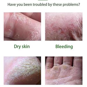 Crema para Pies con Aceite de Árbol de Té, Marca Privada OEM Personalizada al por Mayor, Hidrata, Suaviza y Acondiciona los Pies Secos y Agrietados - Product Image 2