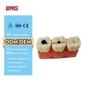 Modelo educativo de ciencia médica, modelo de desmontaje de caries de tamaño 4 veces - Product Image 6