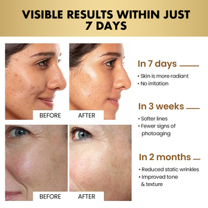 Soins de la <span class=keywords><strong>peau</strong></span> de luxe raffermissant éclaircissant réparateur rides beauté crème pour le <span class=keywords><strong>visage</strong></span> hydratant Anti-âge crème pour le <span class=keywords><strong>visage</strong></span> Lotion pour les femmes - Product Image 5