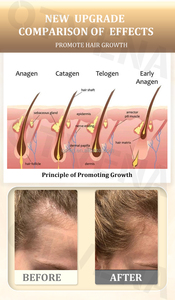 Huile de croissance <span class=keywords><strong>des</strong></span> cheveux biologique OTVENA, prévient la perte de cheveux, la calvitie, la repousse <span class=keywords><strong>des</strong></span> <span class=keywords><strong>sourcils</strong></span>, de la barbe et <span class=keywords><strong>des</strong></span> cheveux - Product Image 5
