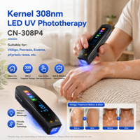 Lampe UV LED portable CN-308P4 avec batterie intégrée, haute intensité 40mW, UVB à bande étroite, usage personnel, Vitiligo, Psoriasis, Eczéma