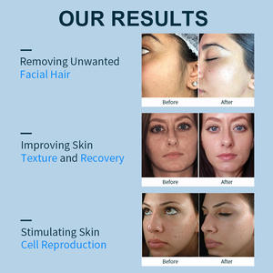 Rasoir électrique pour femmes Rasoir sans fil rechargeable pour femmes Épilation portable Dermaplaning pour visage et bras Bikini - Product Image 4