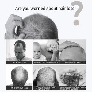 Disaar 2022 Soins capillaires Anti-chute de cheveux Spray tonique Gingembre Nourrissant Produits réparateurs pour hommes et femmes - Product Image 3