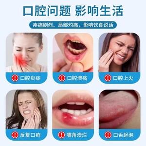 Solución Reparadora Bucal 30ml Spray para la Salud Dental para Úlceras Bucales e Inflamación de Encías - Product Image 5