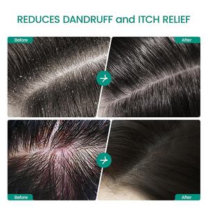 Pegatinas Personalizadas para el Cuidado del Cabello Orgánico, Exfoliante para el Cuero Cabelludo con Biotina y Ácido Salicílico, Tratamiento para la Caspa - Product Image 6