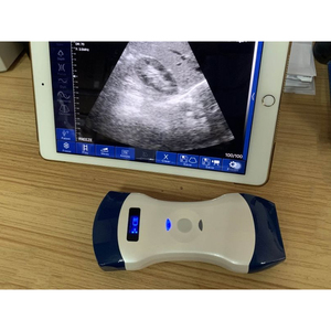 Fabrieksmatig gemaakte schapenvormige convexe lineaire array 3,5/7,5MHz probe voor Cat PW dual probe draadloze <span class=keywords><strong>Doppler</strong></span> echografie apparaat USG - Product Image 6