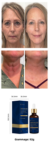 Suero Facial de Niacinamida Personalizado OEM, Reduce la Melanina y las Manchas Oscuras, Reduce los Poros, Suaviza, Ilumina la Piel, Hidrata, Rejuvenece, Cuidado de la Piel - Product Image 6
